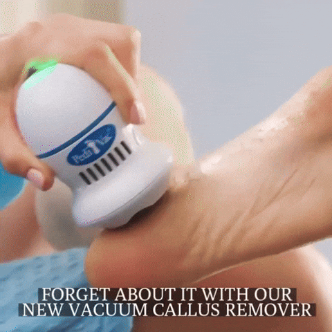 👣 REMOVEDOR DE CALLOS ELÉCTRICO – PIES SUAVES SIN IR AL SALÓN